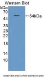 Transcription Termination Factor, RNA Polymerase I (TTF1) Antibody