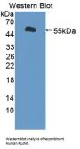 BPI Fold-Containing Family A Member 1 / PLUNC (BPIFA1) Antibody