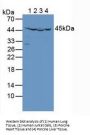 Isocitrate Dehydrogenase 2, Mitochondrial (IDH2) Antibody