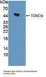 Isocitrate Dehydrogenase 2, Mitochondrial (IDH2) Antibody