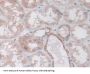 Isocitrate Dehydrogenase 2, Mitochondrial (IDH2) Antibody