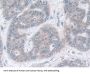 Isocitrate Dehydrogenase 2, Mitochondrial (IDH2) Antibody