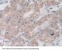 Isocitrate Dehydrogenase 2, Mitochondrial (IDH2) Antibody