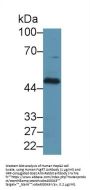Fc Fragment Of IgG Receptor Transporter Alpha (FCGRT) Antibody