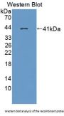 Fc Fragment Of IgG Receptor Transporter Alpha (FCGRT) Antibody