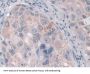 Fc Fragment Of IgG Receptor Transporter Alpha (FCGRT) Antibody