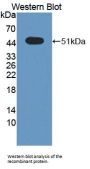 Sprouty Related, EVH1 Domain Containing Protein 2 (SPRED2) Antibody