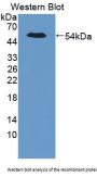 Pygopus Homolog 2 (PYGO2) Antibody