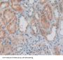 Interleukin 1 Alpha (IL1a) Antibody