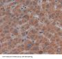 Matrix Metalloproteinase 21 (MMP21) Antibody