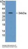 Tyrosine Kinase 2 (TYK2) Antibody
