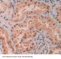 Tyrosine Kinase 2 (TYK2) Antibody