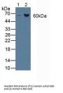 Asparagine Synthetase (ASNS) Antibody