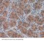 Asparagine Synthetase (ASNS) Antibody