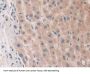 Phospholipase A2, Group X (PLA2G10) Antibody