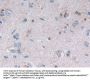 Platelet Activating Factor Acetylhydrolase 2 (PAFAH2) Antibody
