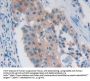 Platelet Activating Factor Acetylhydrolase 2 (PAFAH2) Antibody