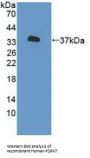 Purinergic Receptor P2X, Ligand Gated Ion Channel 7 (P2RX7) Antibody
