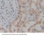 Purinergic Receptor P2X, Ligand Gated Ion Channel 7 (P2RX7) Antibody