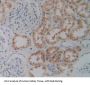 Purinergic Receptor P2X, Ligand Gated Ion Channel 7 (P2RX7) Antibody