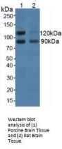 Neural Cell Adhesion Molecule 2 (NCAM2) Antibody