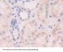 Fibroblast Growth Factor 19 (FGF19) Antibody