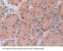Fibroblast Growth Factor 19 (FGF19) Antibody