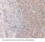 Fibroblast Growth Factor 19 (FGF19) Antibody
