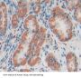 Cytoglobin (CYGB) Antibody