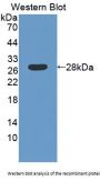 Laminin Beta 4 (LAMb4) Antibody