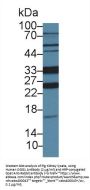 Oxoguanine Glycosylase 1 (OGG1) Antibody