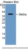 Oxoguanine Glycosylase 1 (OGG1) Antibody