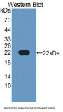 Cancer/Testis Antigen 1B (CTAG1B) Antibody