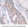 Cancer/Testis Antigen 1B (CTAG1B) Antibody
