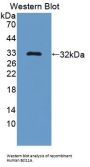 B-Cell CLL/Lymphoma 11A (Bcl11A) Antibody