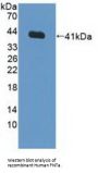 Farnesyltransferase Alpha (FNTa) Antibody