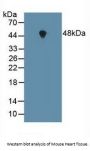 Farnesyltransferase Alpha (FNTa) Antibody