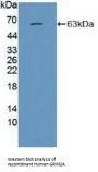 Glutamate Receptor Ionotropic, NMDA 2A (GRIN2A) Antibody