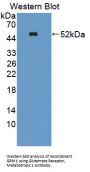 Glutamate Receptor, Metabotropic 1 (GRM1) Antibody