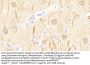 Glutamate Receptor, Metabotropic 1 (GRM1) Antibody