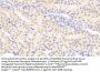 Glutamate Receptor, Metabotropic 1 (GRM1) Antibody