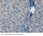 Farnesyl Diphosphate Synthase (FDPS) Antibody