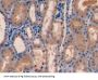 Farnesyl Diphosphate Synthase (FDPS) Antibody