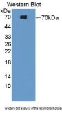 Platelet Derived Growth Factor Receptor Like Protein (PDGFRL) Antibody