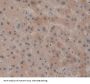 Platelet Derived Growth Factor Receptor Like Protein (PDGFRL) Antibody