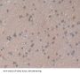 Nuclear Receptor Related Protein 1 (NURR1) Antibody