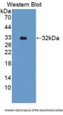 Dipeptidyl Peptidase 8 (DPP8) Antibody