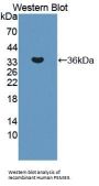 Proteasome Activator Subunit 3 Antibody