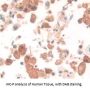 Proteasome Activator Subunit 3 Antibody