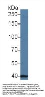 Ubiquitin Associated Protein 2 (UBAP2) Antibody